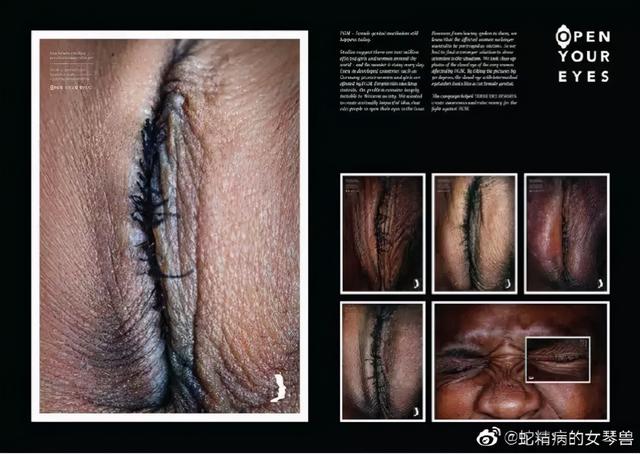 割礼过后的女性是什么样的图片(割礼过后的女性是什么样的图片-)_1
