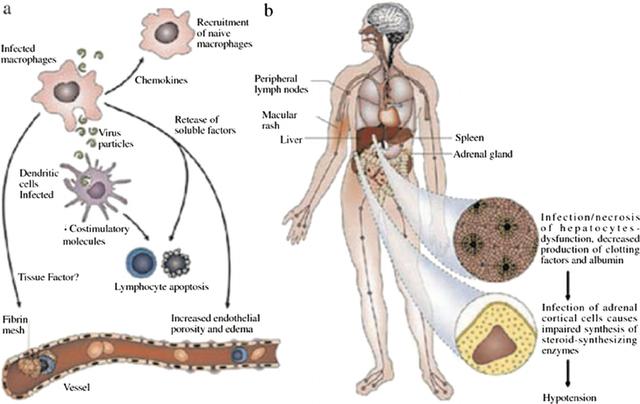 埃博拉吐内脏图(埃博拉吐内脏图片)