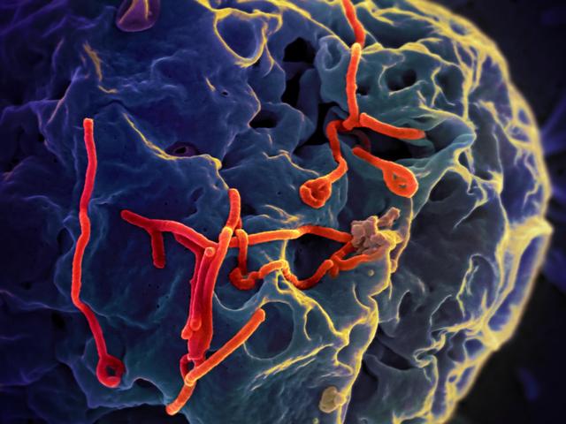 埃博拉吐内脏图(埃博拉吐内脏图片)
