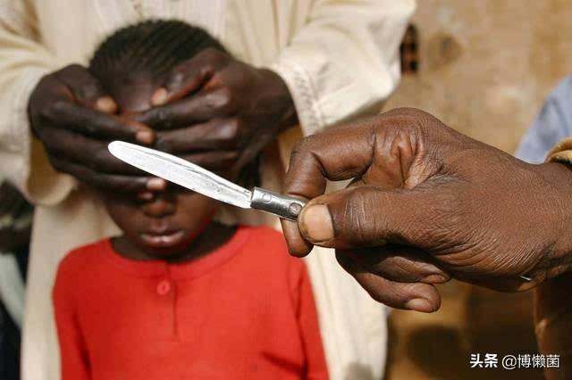 非洲的女性割礼是什么意思呢 新闻？非洲的女性割礼是什么意思呢